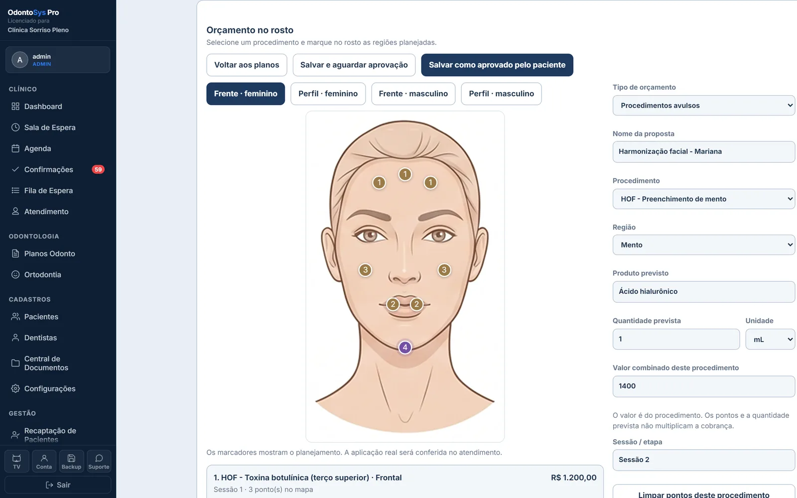 Tela real da Harmonização Orofacial do ClínicaSys Pro: orçamento marcado no rosto